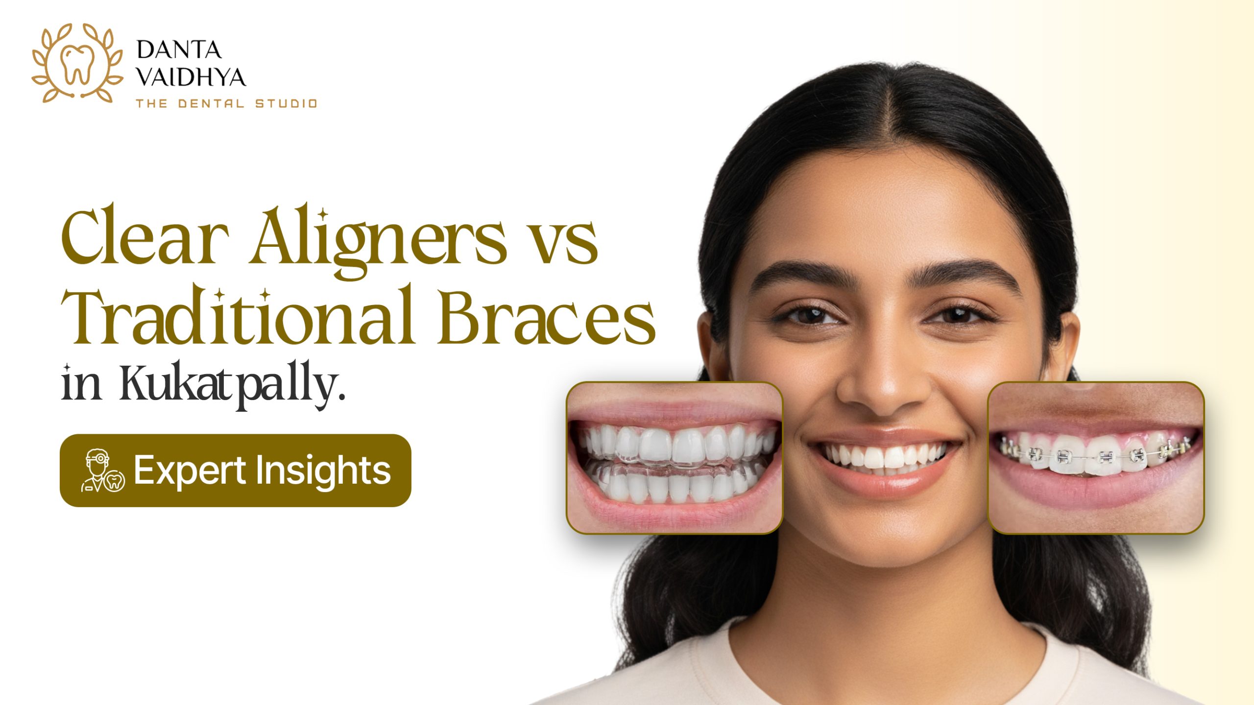 Clear Aligners vs Braces in Kukatpally | Expert Guide