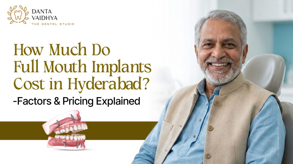 Full Mouth Implants Cost in Hyderabad