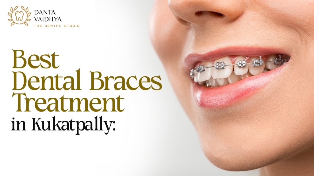 Best Dental Braces Treatment in Kukatpally