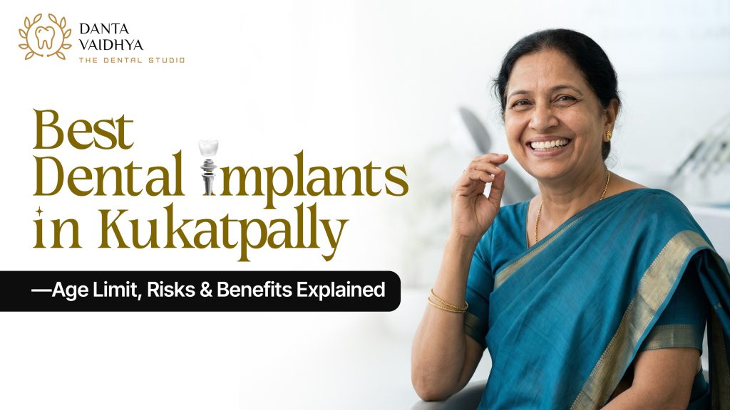 best dental implants in Kukatpally