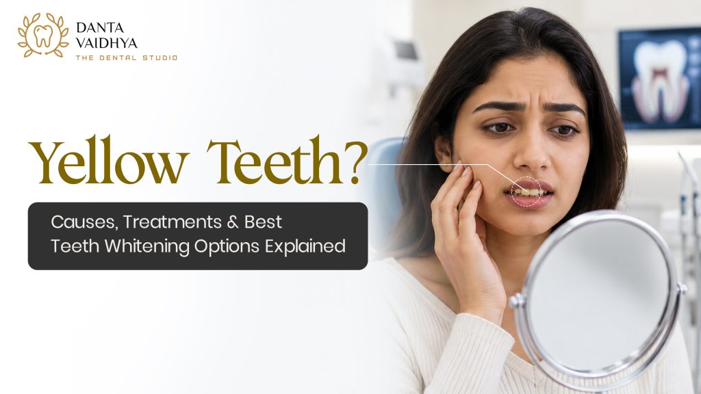 Yellow Teeth? Causes, Treatments & Best Teeth Whitening Options Explained