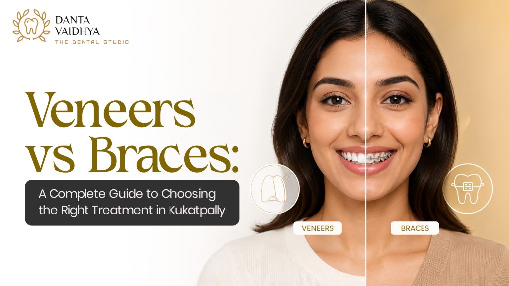 Veneers vs braces in kukatpally