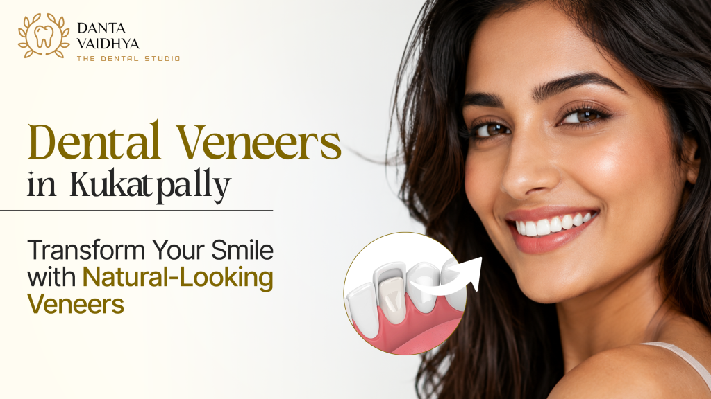 Dental Veneers in Kukatpally – Transform Your Smile with Natural-Looking Veneers