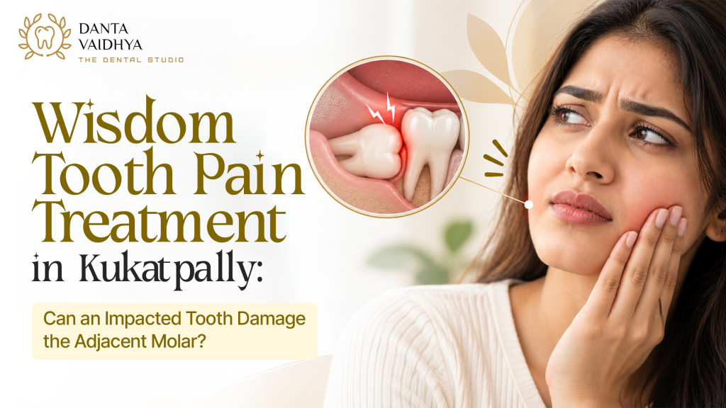 Wisdom Tooth Pain Treatment in Kukatpally: Can an Impacted Tooth Damage the Adjacent Molar?